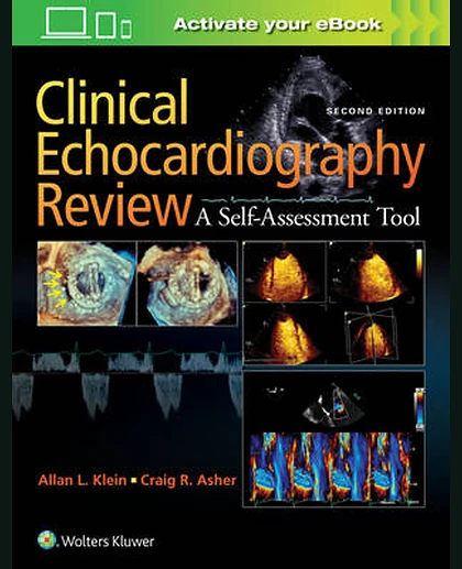 Clinical Echocardiography Review