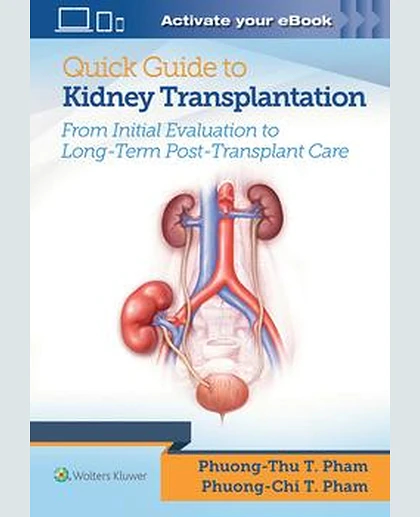 Quick Guide to Kidney Transplantation