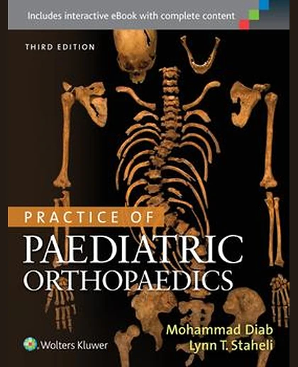 Practice of Paediatric Orthopaedics
