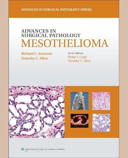 Mesothelioma