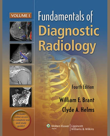 Fundamentals of Diagnostic Radiology - 4 Volume Set