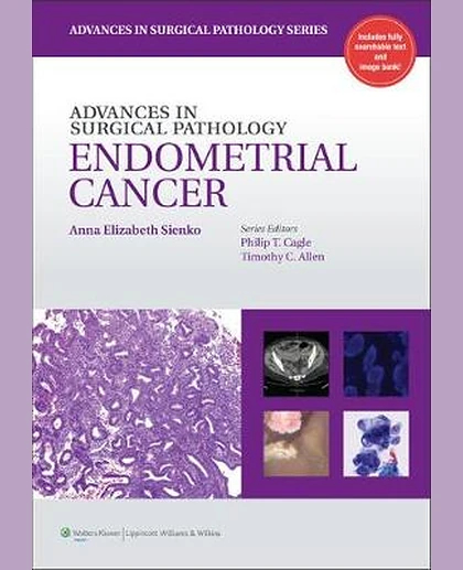 Advances in Surgical Pathology: Endometrial Carcinoma