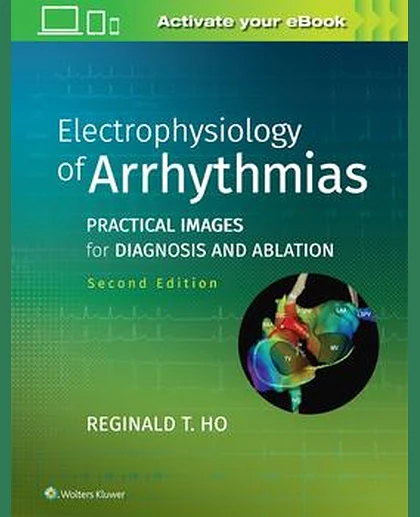 Electrophysiology of Arrhythmias