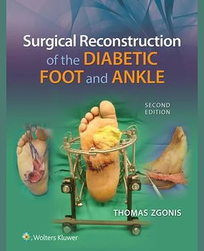 Surgical Reconstruction of the Diabetic Foot and Ankle