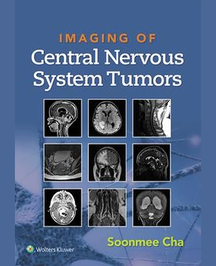 Imaging of CNS Tumors