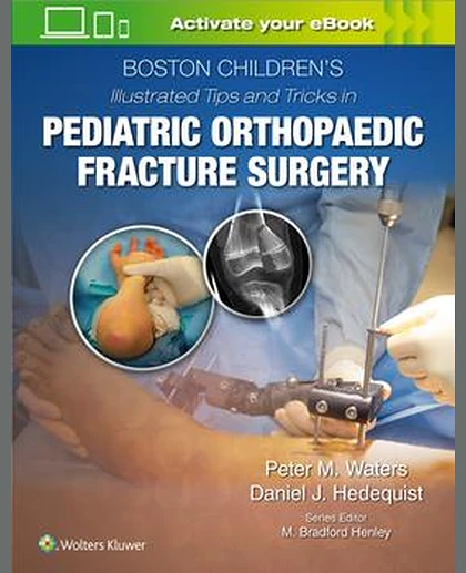 Boston Children’s Illustrated Tips and Tricks in Pediatric Orthopaedic Fracture Surgery