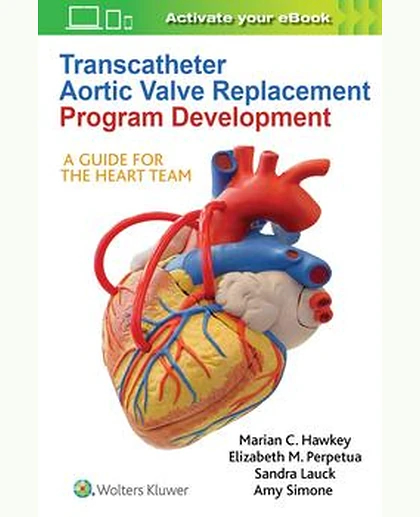 Transcatheter Aortic Valve Replacement Program Development