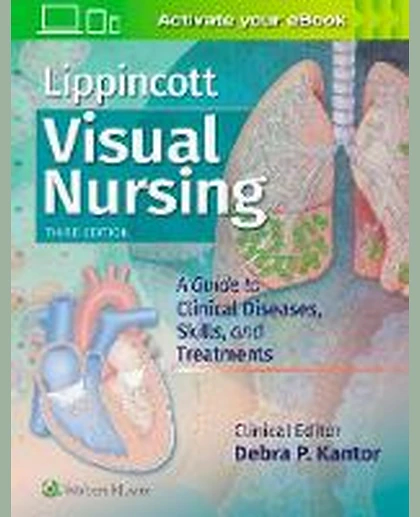 Lippincott Visual Nursing: A Guide to Diseases, Skills, and Treatments