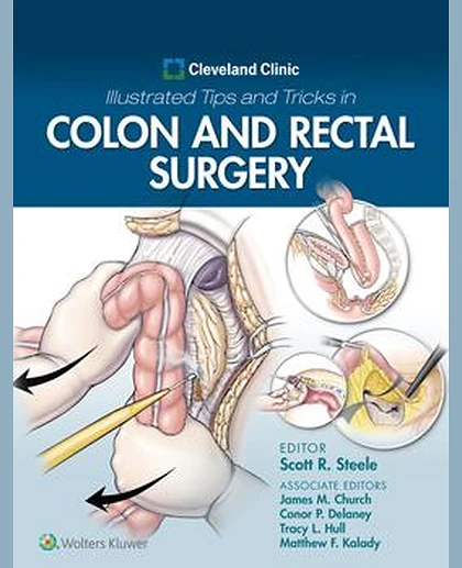 Cleveland Clinic Illustrated Tips and Tricks in Colon and Rectal Surgery