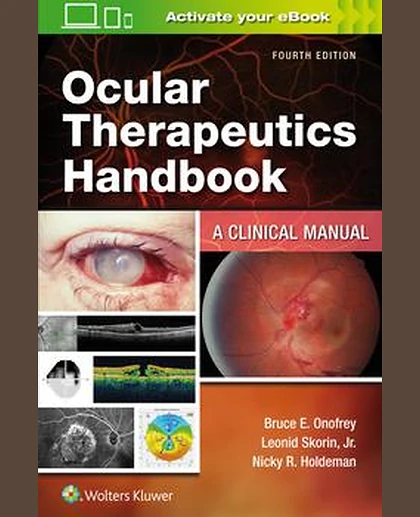 Ocular Therapeutics Handbook
