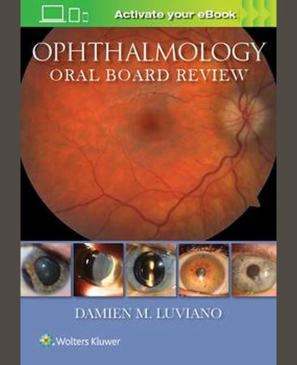 Ophthalmology Oral Board Review
