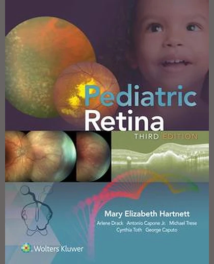 Pediatric Retina
