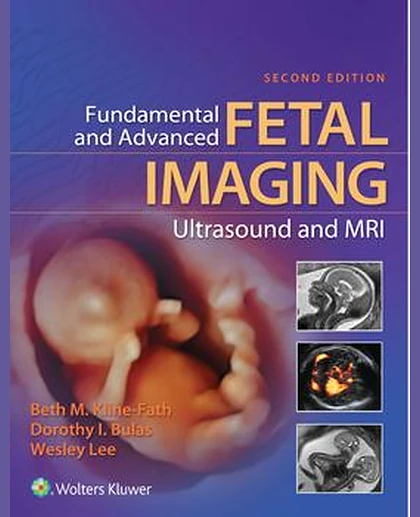 Fundamental and Advanced Fetal Imaging Ultrasound and MRI