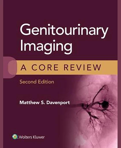 Genitourinary Imaging: A Core Review