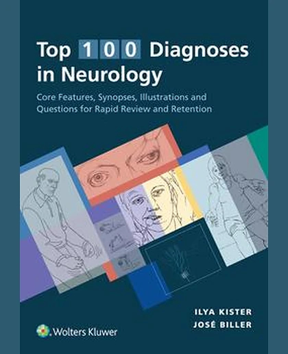 Top 100 Diagnoses in Neurology