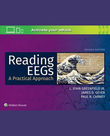 Reading EEGs: A Practical Approach