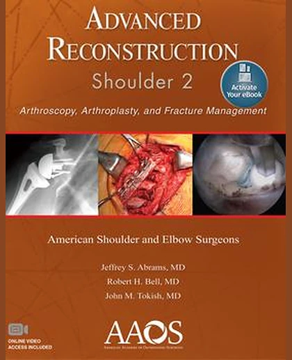 Advanced Reconstruction: Shoulder 2
