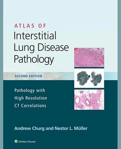Atlas of Interstitial Lung Disease Pathology