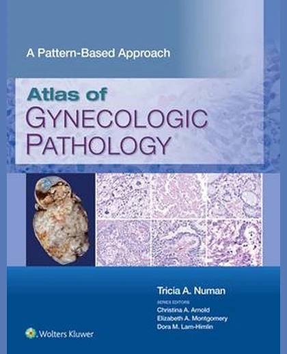Atlas of Gynecologic Pathology