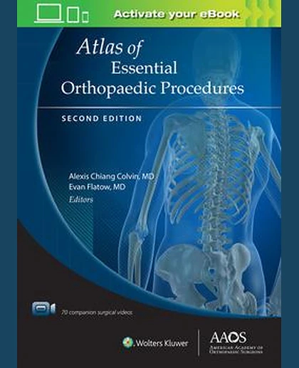 Atlas of Essential Orthopaedic Procedures, Second Edition