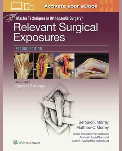 Master Techniques in Orthopaedic Surgery: Relevant Surgical Exposures