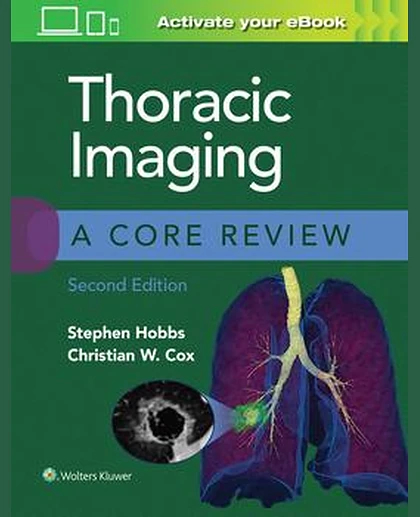 Thoracic Imaging: A Core Review