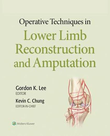 Operative Techniques in Plastic Surgery: Lower Limb Surgery