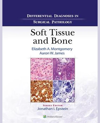 Differential Diagnoses in Surgical Pathology: Soft Tissue and Bone