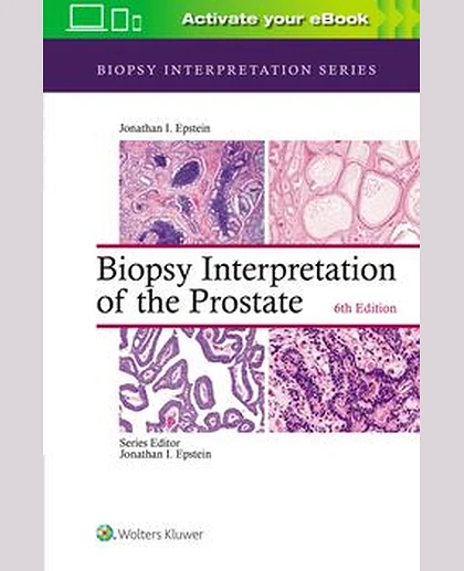 Biopsy Interpretation of the Prostate