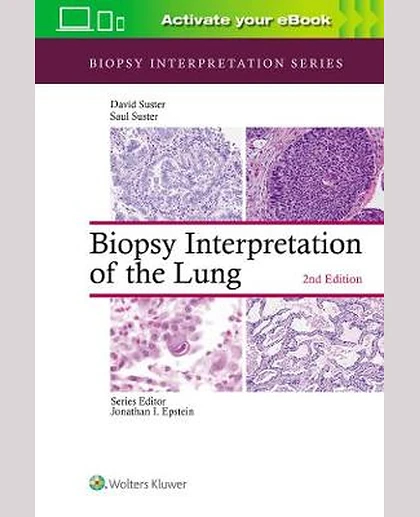 Biopsy Interpretation of the Lung