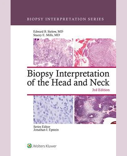 Biopsy Interpretation of the Head and Neck