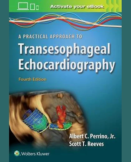 A Practical Approach to Transesophageal Echocardiography
