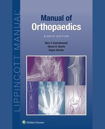 Manual of Orthopaedics