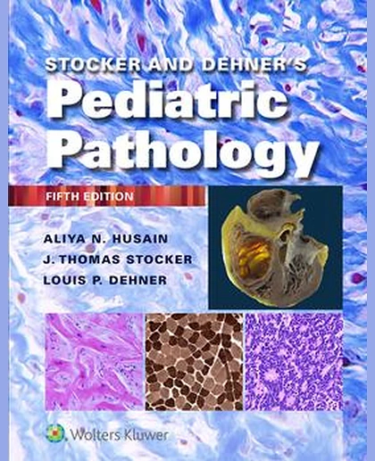 Stocker and Dehner's Pediatric Pathology