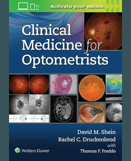 Clinical Medicine for Optometrists