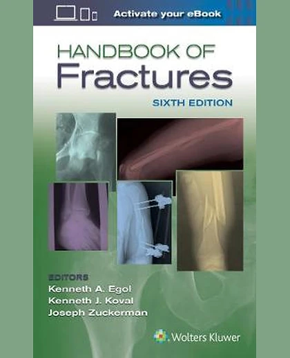 Handbook of Fractures