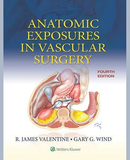 Anatomic Exposures in Vascular Surgery