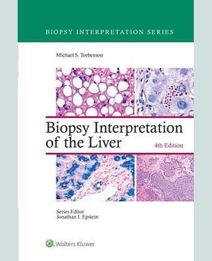 Biopsy Interpretation of the Liver