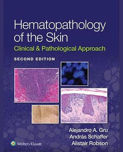Hematopathology of the Skin