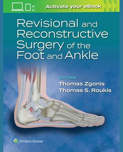 Revisional and Reconstructive Surgery of the Foot and Ankle