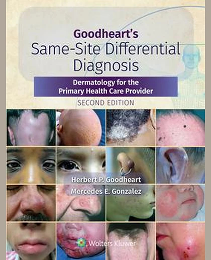 Goodheart's Same-Site Differential Diagnosis