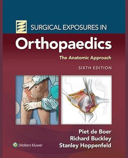 Surgical Exposures in Orthopaedics: The Anatomic Approach