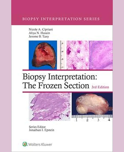 Biopsy Interpretation: The Frozen Section
