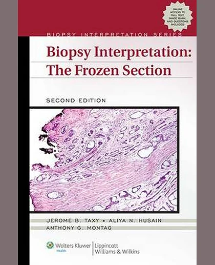 Biopsy Interpretation: The Frozen Section