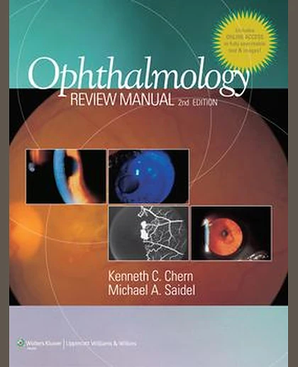 Ophthalmology Review Manual