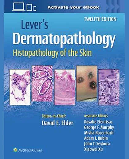 Lever's Dermatopathology: Histopathology of the Skin