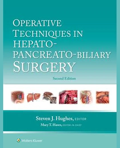 Operative Techniques in Hepato-Pancreato-Biliary Surgery