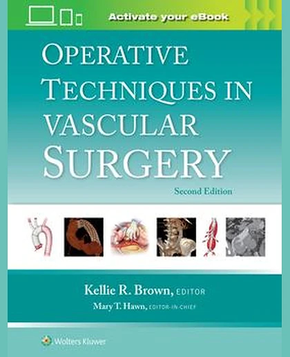 Operative Techniques in Vascular Surgery