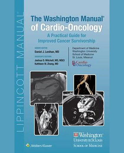 The Washington Manual for Cardio-Oncology