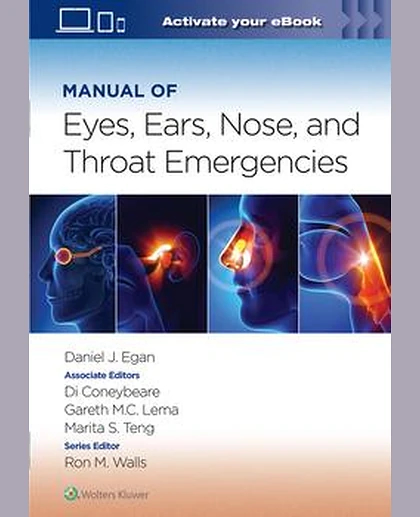Manual of Eye, Ear, Nose, and Throat Emergencies